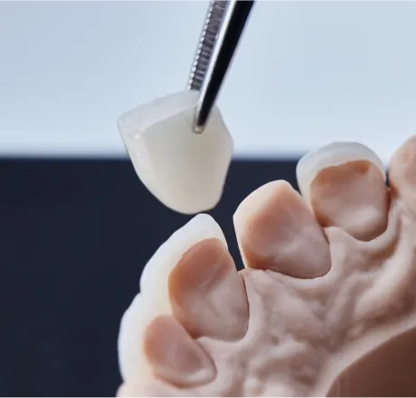 Dental Veneers Icon